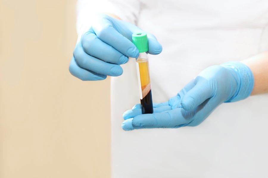 How PRP Treatment Supports Hair Regrowth Houston, TX How PRP Treatment Supports Hair Regrowth Houston, TX
