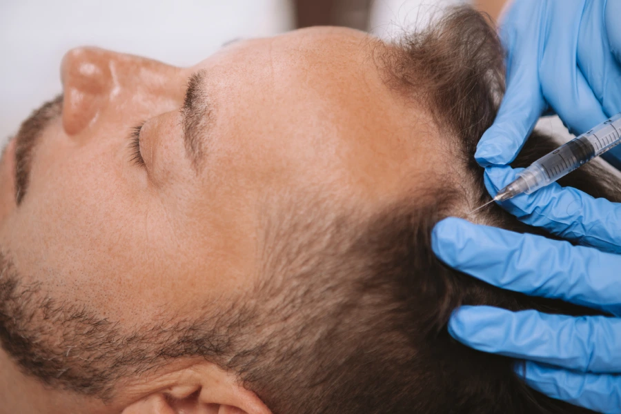 How PRP Treatment Supports Hair Regrowth in Houston, TX How PRP Treatment Supports Hair Regrowth in Houston, TX