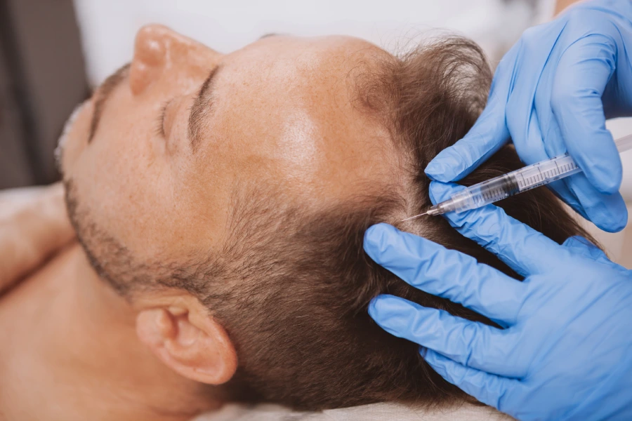 PRP Treatment and Hair Restoration Goals Houston, TX PRP Treatment and Hair Restoration Goals Houston, TX