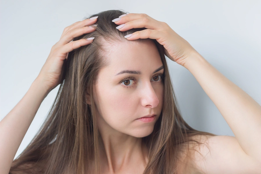 Reliable Alopecia Treatment Houston, TX Reliable Alopecia Treatment Houston, TX